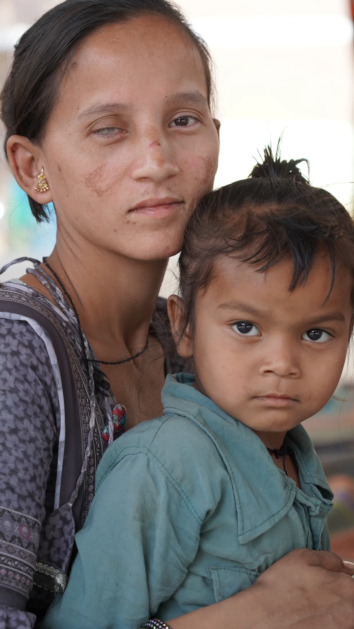 Community healthcare and nutrition outreach – Healthcare Program